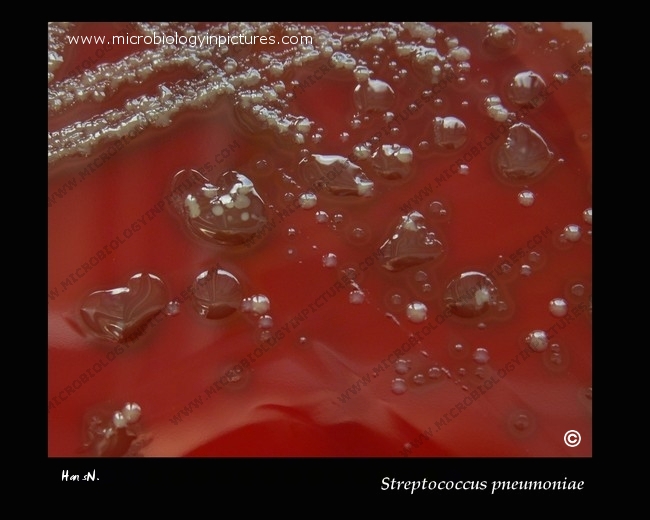 mucoid form of pneumococcus, colony morphology
